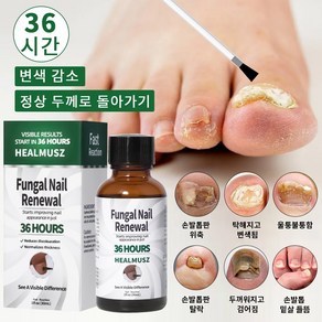 HEALMUSZ 발톱 무좀 앰플 네일 리페어 발톱 강화 발톱 영양제 문제성 발톱 케어 효과보장, 2개, 30ml