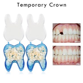 5pcs 치과 임시 치아 전방 후부 재료 액세서리 도구, 단일옵션, 1개