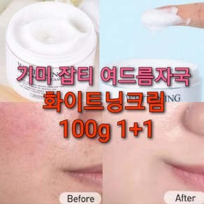 기미 검버섯 화이트닝크림 100g/멜라닌 크림, 1+1개, 1개, 100g