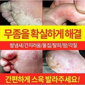 {국내 배송/일본 도쿄 R&D} 발 냄새를 빠르게 제거 / 무좀소독 / 가려움증 방지 및 살균 / 발 필링 / 발흘림 / 발흘림 / 물집 / 기타 발 관리LY009