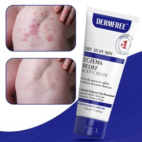 DERMFREE 두드러기 피부 가려움 피부염 크림