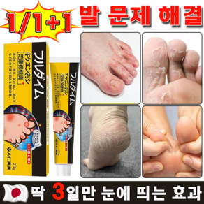 [국내 배송] 일본 발 가려움 연고 발바닥 발가락 가려움증 완화 발냄새 제거 크림 진균 리페어 곰팡이 살균 발톱 케어, 1개, 20g