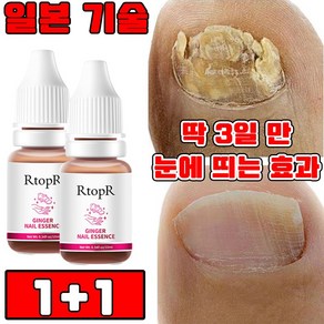 [당일 배송] 1+1/2+2 발톱 무좀 앰플 네일 리페어 발톱 강화 발톱 영양제 문제성 발톱 케어 효과보장