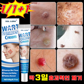 [국내 배송] 피부 제거 연고 편평 제거제 기미 제거 크림 얼굴 점빼기 손 목 치료 연고 깨끗하게 효과적인 포장증정, 1개