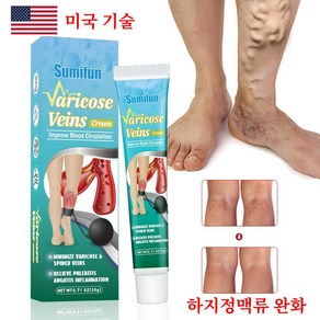 [미국 기술/당일배송] 빠른 치료 정맥류완화 연고 하지정맥 크림 바디 케어 붓기관리 붓기크림 혈관염[국내배송], 1개