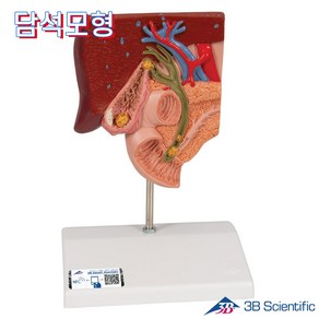 3B Scientific 인체해부모형 담석모형 K26 Gallstone Model