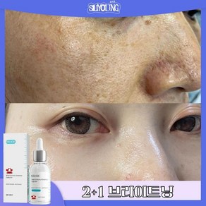 [피부과입점] 검버섯제거 기미잡티 케어 주름 미백 기능성 검버섯앰플, 30ml, 2개