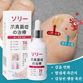 손발톱영양제 발톱 리페어에센스 문제성 손발톱 케어제, 1개, 50ml