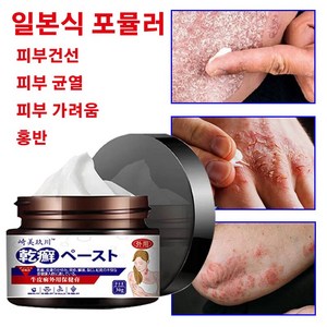 건선 건선 크림 습진 피부 가려움증 홍반 피부 균열 보습 크림, 1개, 30g