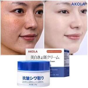 AKOLA 기미 잡티 주근깨 제거 크림 얼굴 색소침착 개선 화이트닝 & 주름 케어, 1개, 30g