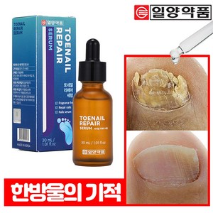 일양약품 문제성 손발톱 전문 리페어 세럼 영양제 토네일, 1개, 30ml