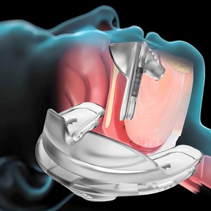 메디슬립 코골이 수면무호흡증 양압기 겸용 입벌림 입마름 코막힘 방지 코호흡, 1개