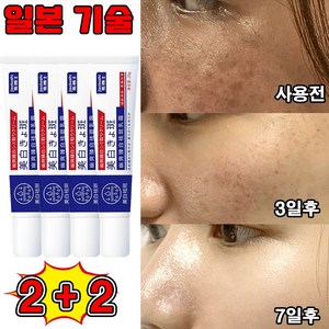 [100% 제거] 일본 1+1/2+2 얼굴 기미 잡티 미백 크림 주근깨 검버섯 제거 크림 색소침착 멜라토닝 착색 화이트닝 사은품 랜덤 증정, 4개, 20g