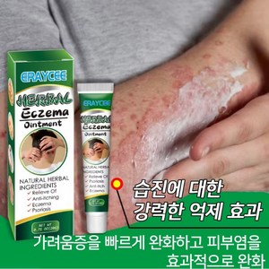 피부헤르{일본 수입 국내 배송} 천연 순수 식물 추출물 습진 연고비늘 습진 완화두드러기가려운 피부헤르페스건성 피부알레르기 물집등LY002, 2개, 20g