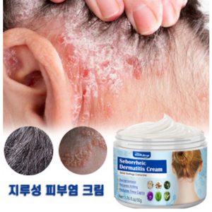 (국내배송) 지루성두피 비듬 각질 가려움, 1개, 50ml