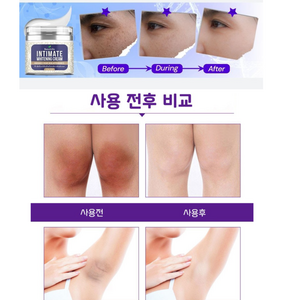 화이트닝 크림 검버섯 다크써클 검은입술 겨드랑이 Y존 색소침착 완화크림 [Beautzilla Intimate whitening ceam], 2개, 50ml