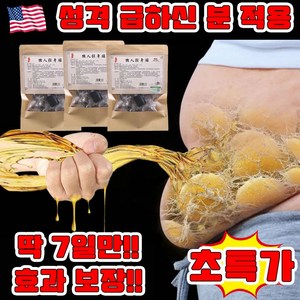 [다이어트 100% 성공] 2+2/3+3 한방 쑥뜸 배꼽 패치 뱃살 다이어트 패치 습기 제거 건강 치습 배독 패치 슬리밍 뱃살 빼기 안심배송 증정, 1개, 30개입