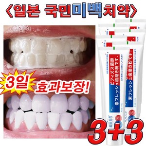 [치과 추천] 일본 1+1/2+2 미백치약 치아미백제 치아 화이트닝 입냄새/누렁이/구취 제거 치약/선물 랜덤 증정, 6개, 110g