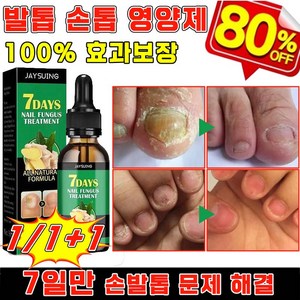 [국내 배송] 손발톱 영양제 문제성 발톱 손톱 강화제 발톱 케어 앰플 네일 리페어 곰팡이 살균, 2개, 30g