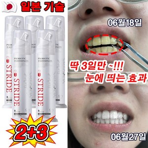 [딱 3일만] 일본 1/1+1 누렁이 미백 치약 구취케어 착색제거 충치예방 치아 미백제, 100g, 5개