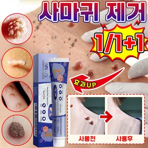 [국내배송] 1+1/2+2 미국 피부 치료 제거 연고 신속하고 효과적인 제거 스킨 제거 크림 최저가격 포장증정, 1세트, 20g