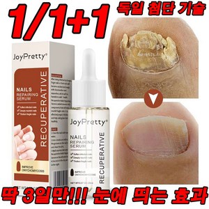 최신 기술 1/1+1 딱 3일!!! 효과보장 발톱 완화 영양제 천연 성분 손톱 리페어 에센스, 1개, 20ml