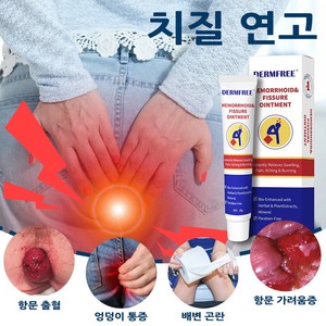 Demfee 항문 케어 크림 항문 가려움 배변 곤란 엉덩이 통증 완화 종합 허브크림 효과적 치료치질, 2개, 20g