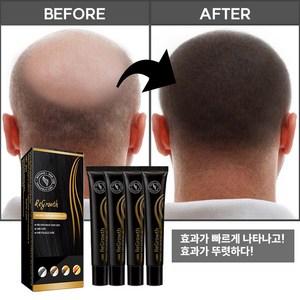 [국내당일발송]탈모 증상 모발 성장 롤러 두피 케어 에센스, 1개, 20ml