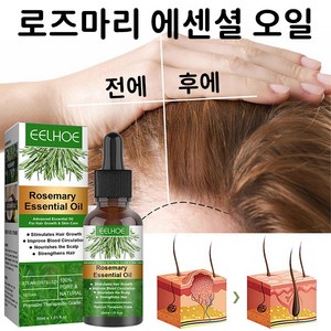 Akola 로즈마리 모발 에센셜 헤어에센스 헤어 세럼 분기 된 모발 개선하기 탈모 예방 헤어오일, 3개, 30ml