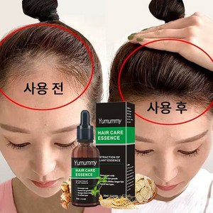 Hai Hai Gowe 영 양 두 피 케 어 세 럼, 1개, 30ml