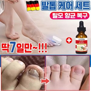 [빠른 배송] 미국기술 가정용 손발 발톱 관리 기기 곰팡이 제거 발 케어, 1세트, 기기+에센스