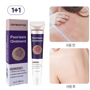 DRYMATYINE 건선 크림 습진크림 발진 가려움 두피건선 가려움완화, 2개, 20ml