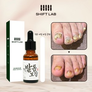 발톱보감 문제성발톱 솔루션 손발톱영양제 손발톱연화제 케어 엠플 20ml, 1개, 1개입