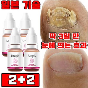 [당일 배송] 1+1/2+2 발톱 무좀 앰플 네일 리페어 발톱 강화 발톱 영양제 문제성 발톱 케어 효과보장, 4개, 10ml