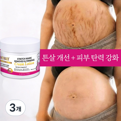 임신 크림 Stretch Mark Cream 임신부 바디 로션 산후 크림, 3개, 150g