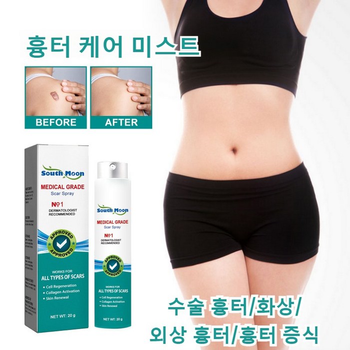 흉터 케어 미스트 수술흉터 화상물집 쌍꺼풀흉터 제왕절개흉터 흉터제거연고 재생크림 과민성 흉터흉터 증식, 5개