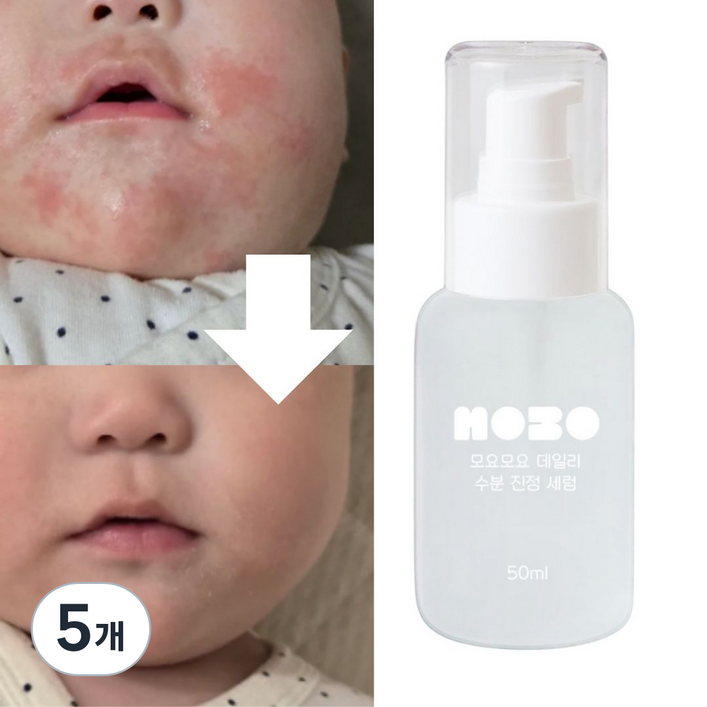 모요모요 침독크림 아기태열 초등학생앰플 고학년 사춘기 여드름화장품, 5개, 50ml