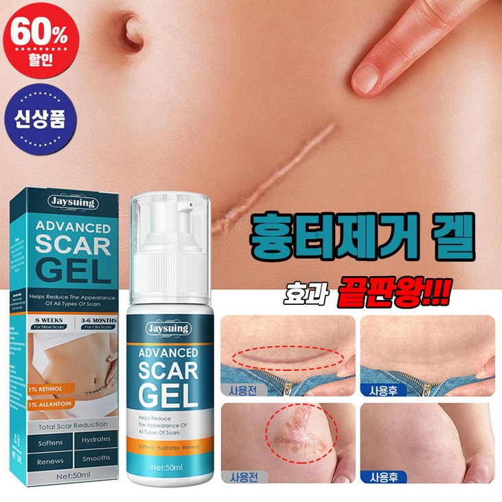 국내배송 흉터제거 연고 제왕절개 화상 수술 상처 피부흉터 제거겔 켈로이드 치료 리페어 크림