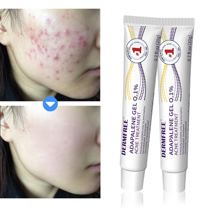 DERMFREE 여드름 제거 리페어 크림 스팟 케어 문제피부 자국 모공 진정 피지케어 연고